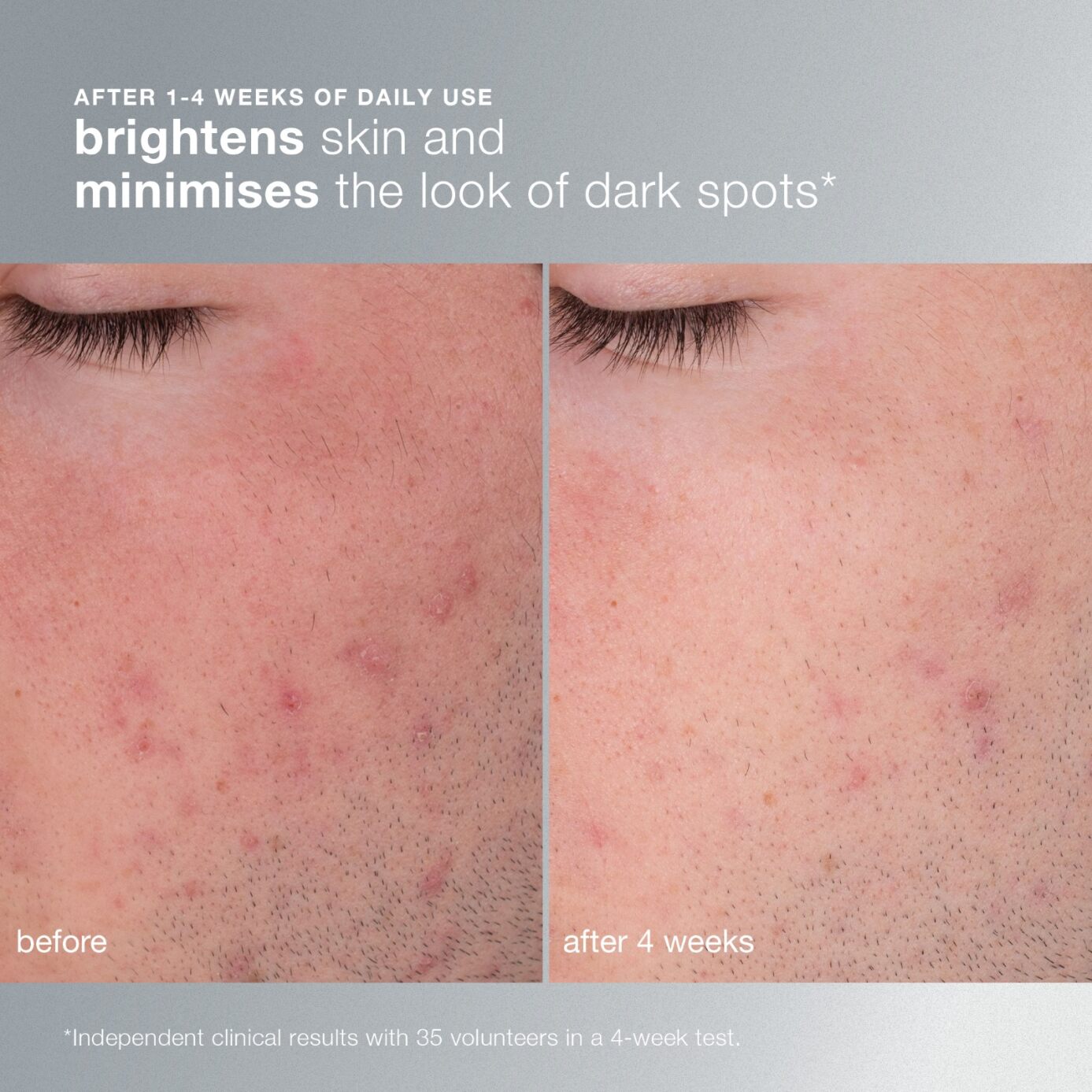 Daily Microfoliant Exfoliant 13g